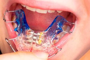 CLINICA DENTAL, ORTODONCIA Y ORTOPEDIA MAXILAR