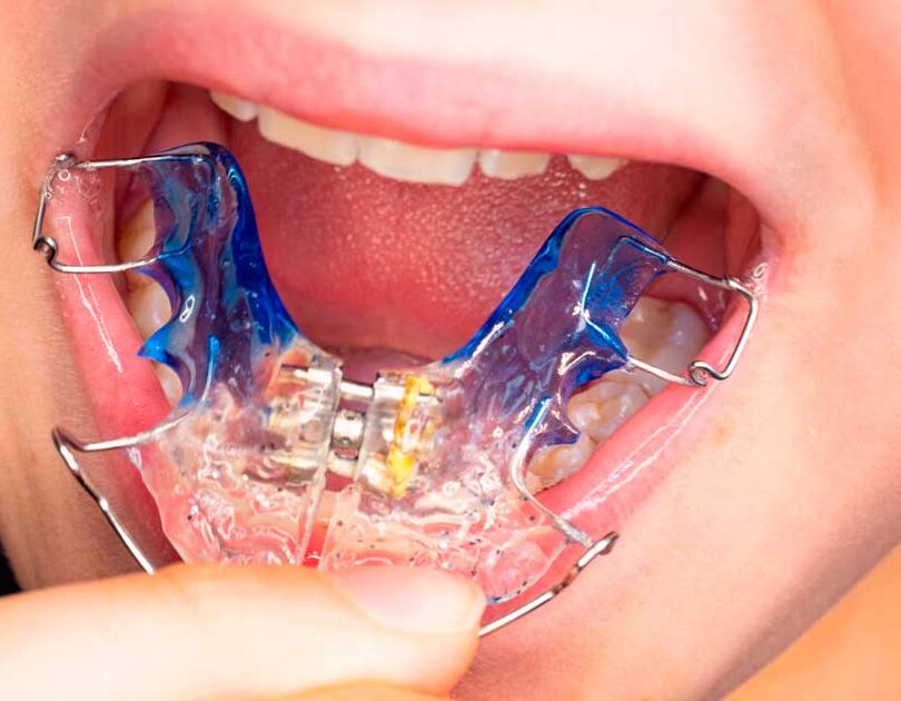 clinica dental ortodoncia y ortopedia