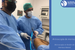 Dr. Eduardo Villanueva Manzo Alta Especialidad en Rodilla, Cirugía de Hombro, Traumatología y Ortopedia Orthotrauma