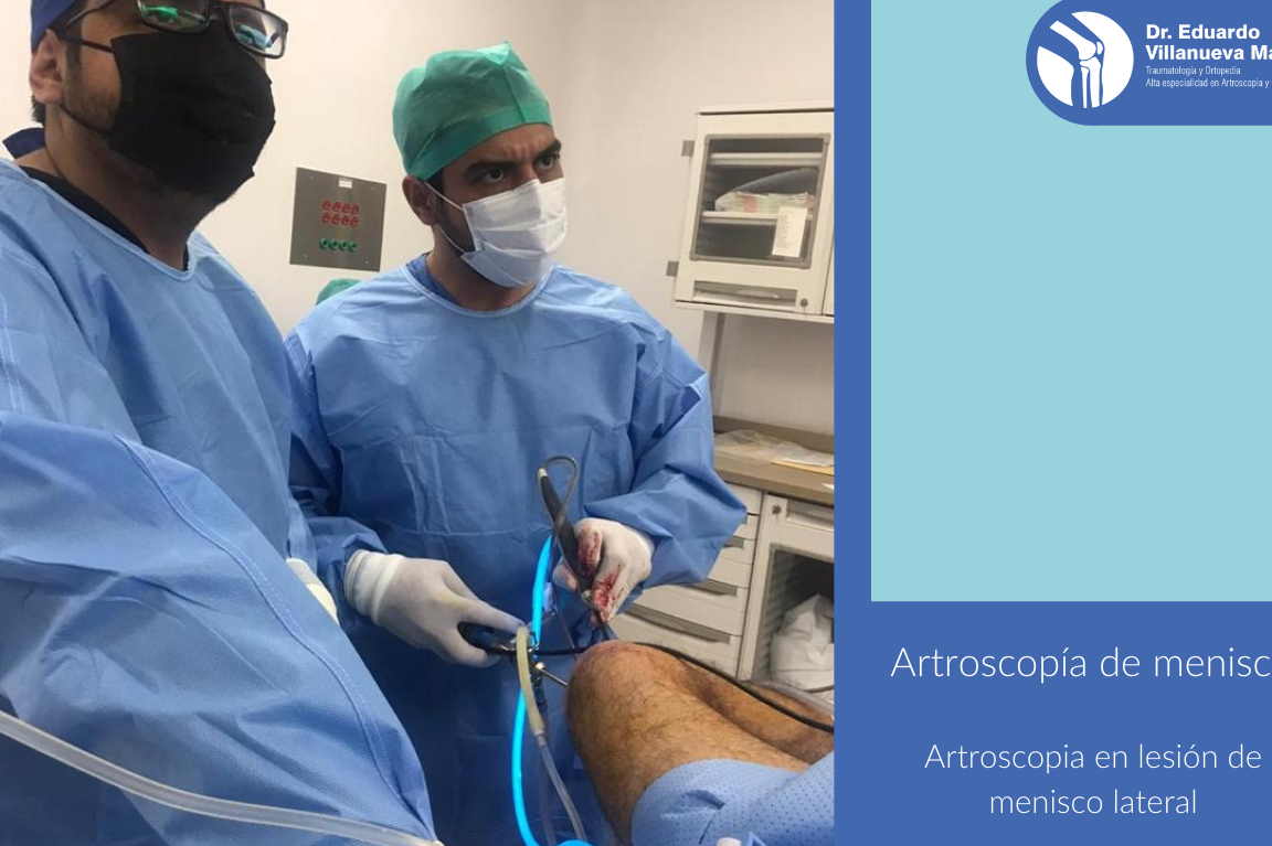 Dr. Eduardo Villanueva Manzo Alta Especialidad en Rodilla, Cirugía de Hombro, Traumatología y Ortopedia Orthotrauma 1 dr eduardo villanueva manzo alta especialidad en rodilla cirugia de hombro traumatologia y ortopedia orthotrauma