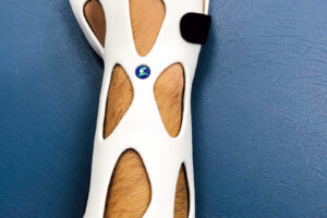 ESPECIALIDADES CASTILLO,PRÓTESIS DE PIERNA, PRÓTESIS DE BRAZO, FÉRULAS Y PLANTILLAS 5 ESPECIALIDADES CASTILLO,PRÓTESIS DE PIERNA, PRÓTESIS DE BRAZO, FÉRULAS Y PLANTILLAS