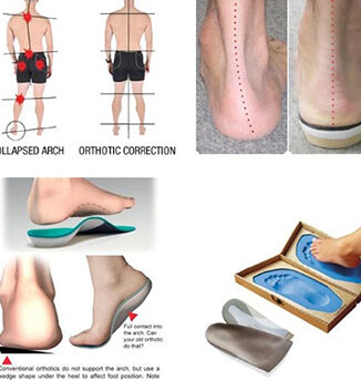 especialista en pie plano pie cavo rotacion interna rotacion externa y elaboracion de ferulas taloneras y plantillas ortopedicas