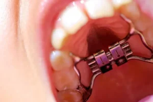 ORTODONCIA Y ORTOPEDIA. ODONTOLOGIA INTEGRAL.