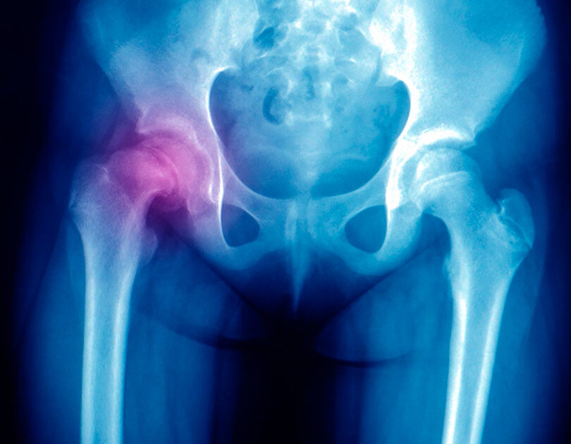 SaltilloSpine Doctor Especialista en Columna Vertebral y Traumatología Ortopedia en Saltillo 1 saltillospine doctor especialista en columna vertebral y traumatologia ortopedia en saltillo