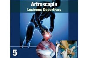 – Traumatología Deportiva Cuautla – ArtroSport Center – Lesiones del Cártilago – Artroscopia – Fracturas
